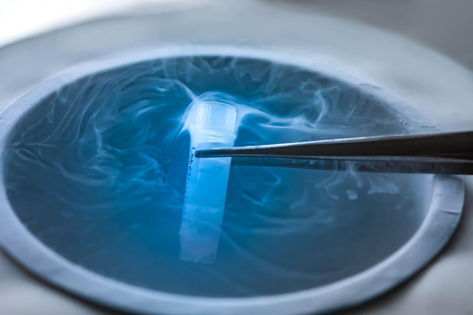 Ovarian Tissue Cryopreservation Transp.